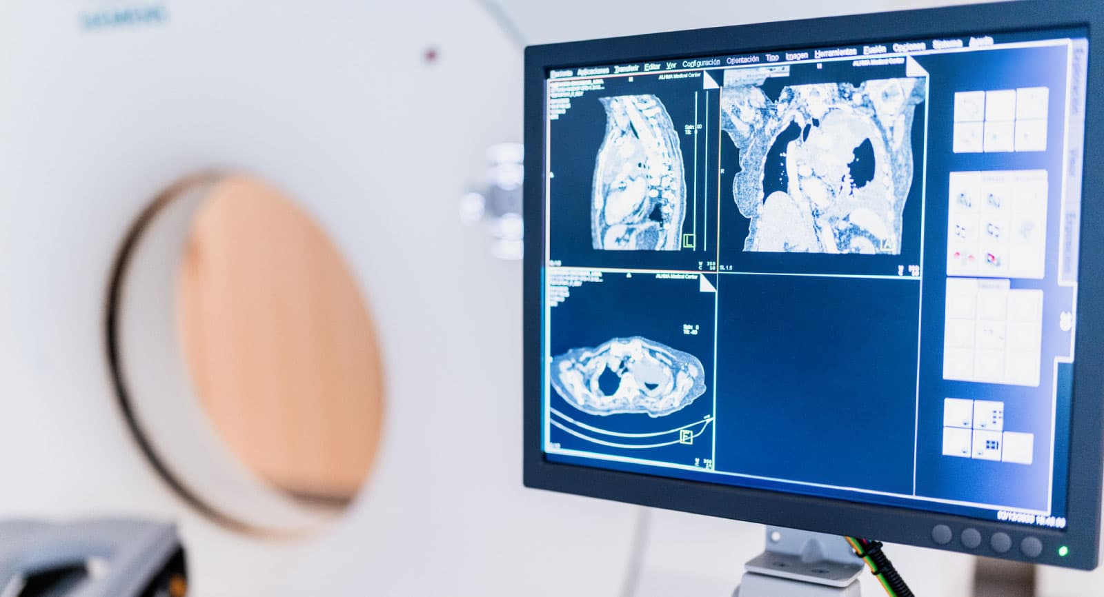 AI radiologiya dashboard - DICOM tahlil interfeysi